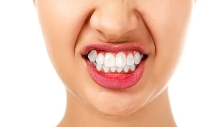 Teeth grinding: are you doing it?