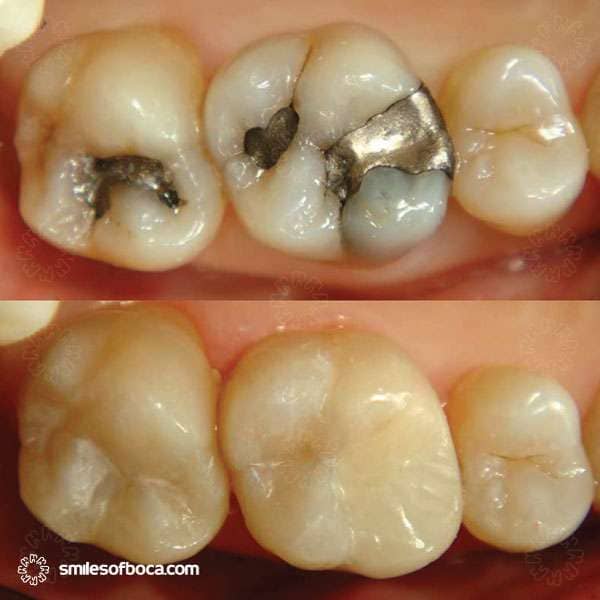 Cerca de una joven feliz con un tono de piel brillante y fresco, mostrando una hermosa sonrisa blanca y sonriendo despreocupada, feliz por el día de San Valentín, de pie sobre un fondo rosa blanqueamiento dental boca raton