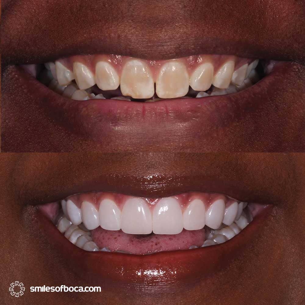 Cerca de una joven feliz con un tono de piel brillante y fresco, mostrando una hermosa sonrisa blanca y sonriendo despreocupada, feliz por el día de San Valentín, de pie sobre un fondo rosa blanqueamiento dental boca raton
